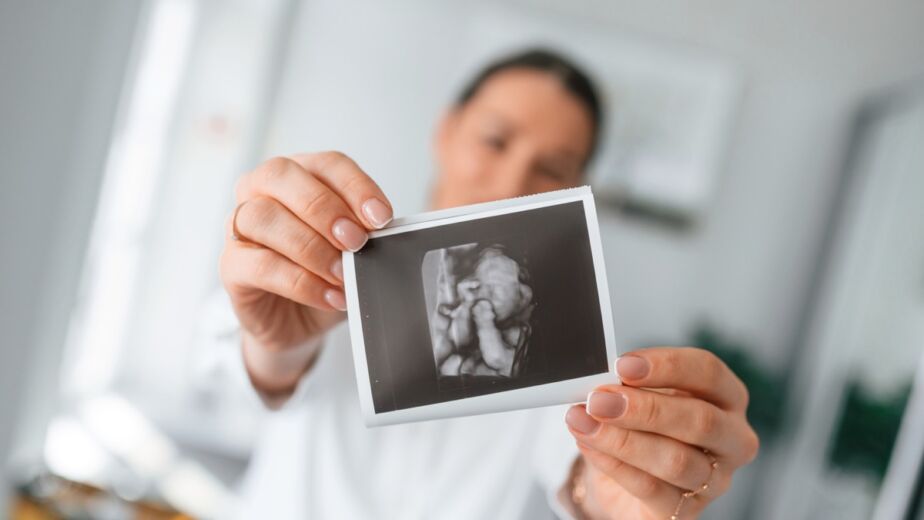 4dhdelectiveultrasound 35_4DUltrasound_Knoxville